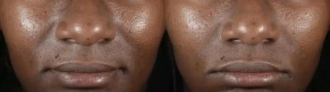 Diamond Glow new ba 3 11zon.jpg Diamond Glow new ba 3 11zon.jpg