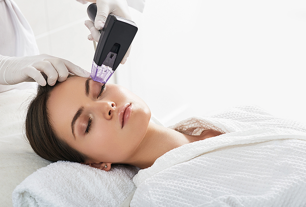 Vivace RF Microneedling Vivace RF Microneedling